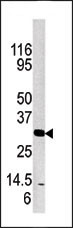 WB - Kallikrein 3 Antibody (C-term) AP6322b